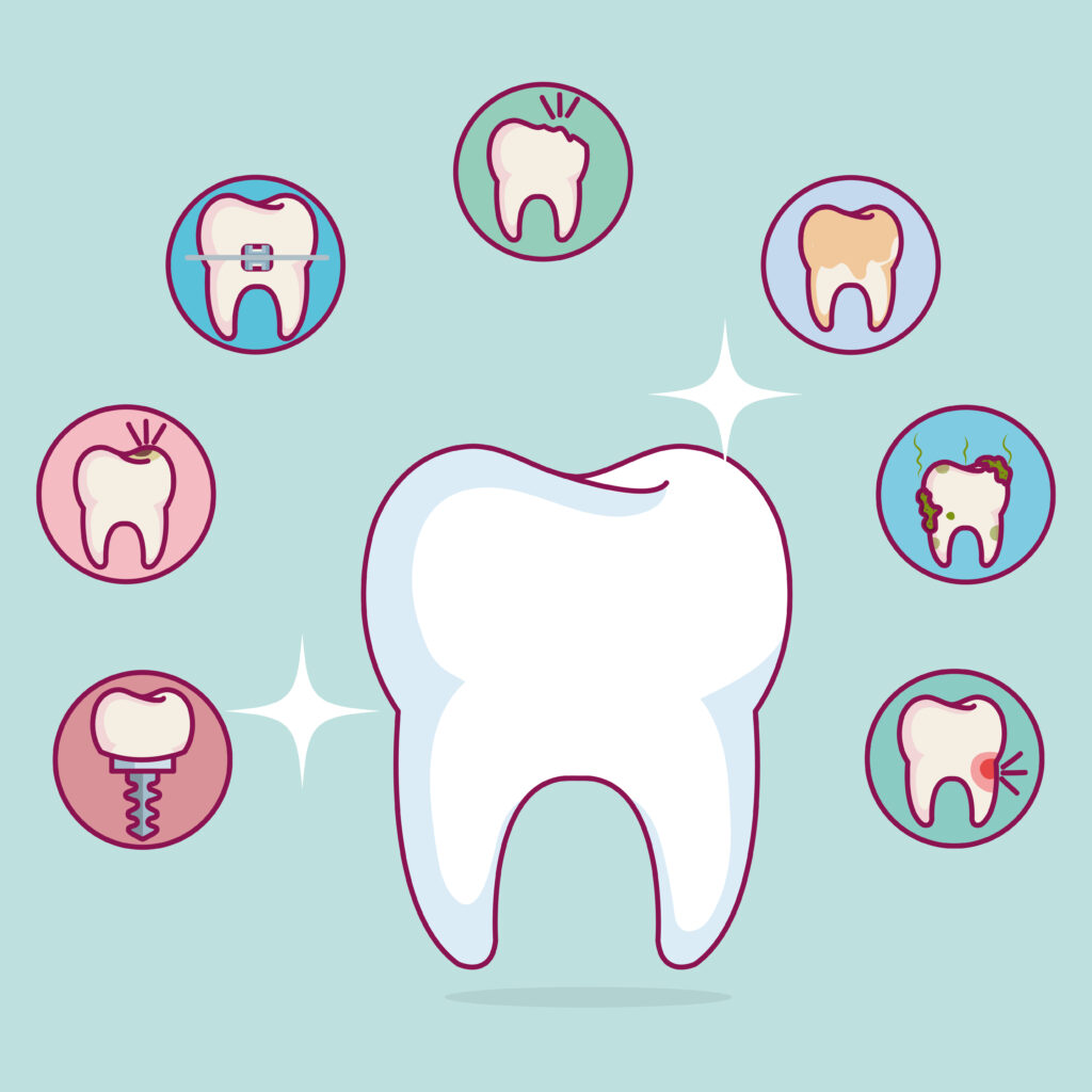 Gambar ilustrasi penyakit pada gigi 