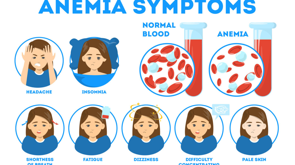 Anemia symptoms infographic. Blood disease. Idea of health
