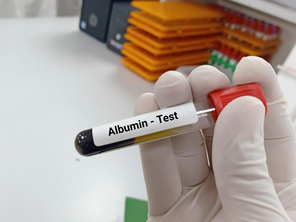 albumin test image