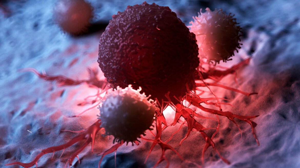 sel tumor kanker